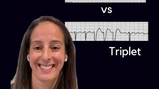 Identifying PVCs  Couplet vs Triplet [upl. by Dwight358]