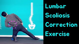 Lumbar Scoliosis Schroth Method Exercise Scoliosis Correction Single Curved Spine [upl. by Navetse]