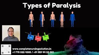 Types of Paralysis amp Its Nursing care nclex nclexpracticequestions paralysis paralysistreatment [upl. by Knowle]