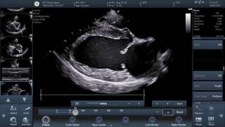 IMV imaging prev BCF Technology Video 3  How to perform basic echocardiographic measurements [upl. by Fusco254]