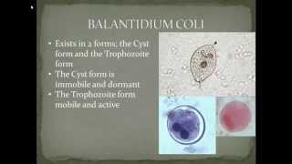 Parasitology Balantidiasis Part 2 [upl. by Eselahs827]