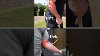 Got Tennis or Golfers Elbow This is How You Fix Them golferselbow tenniselbow elbowpain [upl. by Hewett]