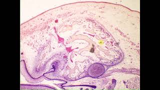 Cancellous spongy bone Pig Embryo snout [upl. by Ezzo343]