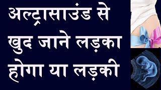 गर्भावस्था के अल्ट्रासाउंड से खुद जाने लड़का होगा या लड़की Gender Prediction by Ramzi Theory in Hindi [upl. by Airamas]