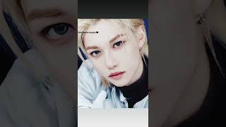 Felix before surgery vs after surgery felix kpop funny meme straykids youmakestraykidsstay [upl. by Imekawulo111]