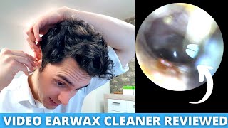 Ear Specialist Reviews Home Ear Wax Removal Camera Bebird Earokay Ear Cleaner [upl. by Ila]