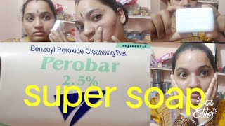 How to remove Pimples in one day perobar super solution in telugu [upl. by Nirrad]