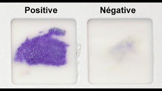 Oxidase Test Practical Tutorial [upl. by Garland659]