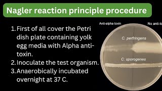 Clostridium perfringens Nagler reaction principle procedure lecithinase test labtech mltbyrahul [upl. by Nilauqcaj]