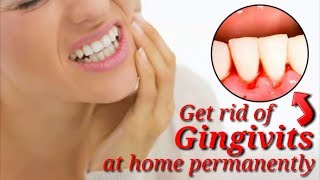 How to get rid of gingivitis quickly by natural remedies tips [upl. by Hayifas]