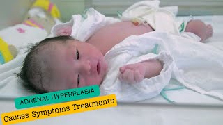 Classic Congenital Adrenal Hyperplasia Causes Symptoms Treatments [upl. by Monteith]