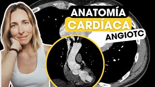 Todo lo que tienes que saber sobre anatomía cardíaca por TC✅ [upl. by Roxi]