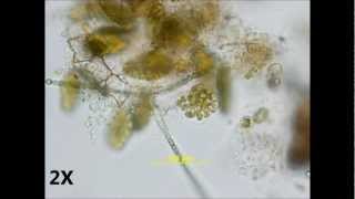 Pediastrum duplex  autocolony formation [upl. by Malan]