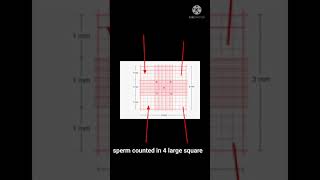 sperm counting in Neubauer chamber shorts [upl. by Ecnerual]