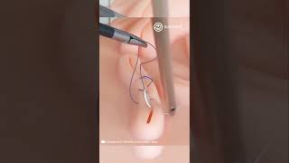 Laparoscopic Suturing Techniques [upl. by Macdonell]