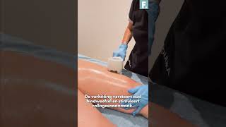 Exilis Elite bij FIGUURA Leeuwarden [upl. by Abroms800]