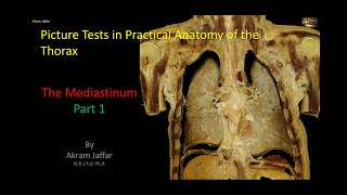 Picture Tests in Anatomy  Thorax  Mediastinum 1 [upl. by Eppesiug]