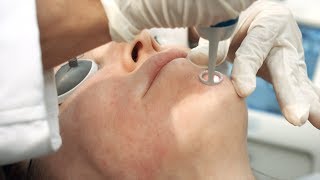 PicoWay Laser by Riverchase Dermatology in Florida [upl. by Ryter338]