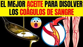 Derretir coágulos de SANGRE de forma NATURAL 6 ACEITES poderosos PRINCIPALES [upl. by Jarlath]