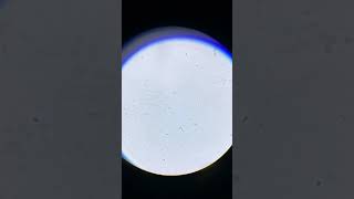 PROTOZOOS en agua estancada bajo el MICROSCOPIO [upl. by Kalmick]