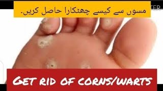 Getrid of CornWarts on foot by Dr Amara 2024Duofilm Lotion Uses in Urdu HindiDr Health [upl. by Hatty]