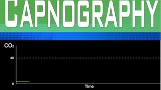 EtCO2 Capnography Part 2 [upl. by Eveleen]