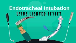 Lighted stylet  Endotracheal intubation [upl. by Nylarahs]