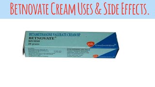 Betnovate Cream for Skin Problems – Everything You Need to Knowquot [upl. by Grimes]