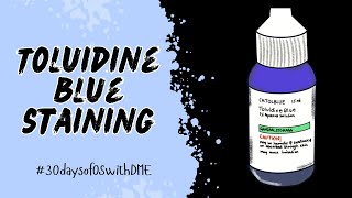 TOLUIDINE BLUE STAINING IN ORAL SURGERY  30daysofOSwithDME [upl. by Aiyotal]