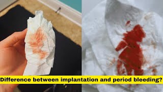 implantation bleeding vs periodimplantation bleeding or periodimplantation vs period [upl. by Jackquelin]