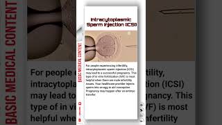 Intracytoplasmic Sperm Injection ICSI icsi ivf pregnancy sperm [upl. by Higgs]