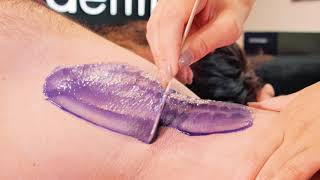 MENS ARMPITS EPILATION WITH EPILODERM VOLUPTÉ WAX [upl. by Eillak]