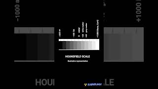 Hounsfield scale CT radiology [upl. by Harbour551]