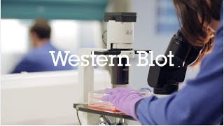 Western blot protocol video [upl. by Labinnah]