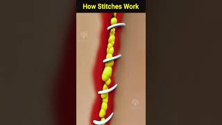 How wound stitches really work shorts facts  Creativelearning3d [upl. by Nosniv]