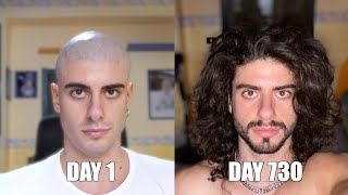 Two years time lapse of hair growth [upl. by Aveline]