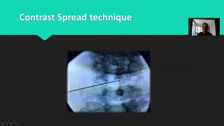 Webinar presentation at British Pain Society ASM 2018 [upl. by Villada657]