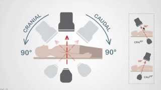 Mastering Coronary Angiography Image Intensifier amp Carm Fundamentals [upl. by Beverie]