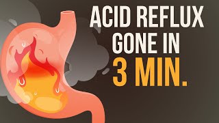 Reduce your Acid Reflux  Heartburn in just 3 Minutes 🔥 [upl. by Inna214]