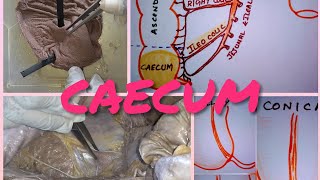 Anatomy of CAECUM [upl. by Roderick]