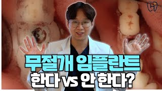 현직 치과의사 피셜 나라면 무절개 임플란트 한다 vs 안한다 [upl. by Laicram]