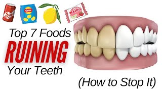 Top 7 Foods Secretly Destroying Your Teeth amp  How to Stop It [upl. by Novej]