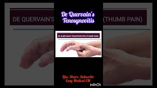 What is De Quervains TenosynovitisPhysiotherapy for Thumb Pain thumbpainshortvideo shortfeed [upl. by Halli]