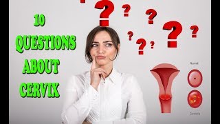 Cervix  10 questions to answer to help you decide whether or not to keep your cervix [upl. by Ralston208]