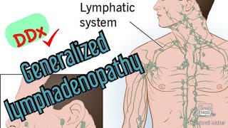 Approach to Diagnosing Generalized Lymphadenopathy [upl. by Ayanal581]