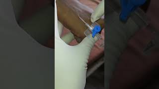 How to insert iv cannula in vein  cannulation technique medical short [upl. by Aisat]