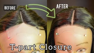 How To Fix unnatural Knots On A Tpart Closure  Pluck Reventilating  Naturallooking Hairline [upl. by Grinnell]