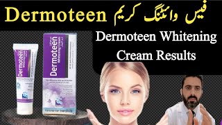 Dermoteen Whitening Cream Review Hand and Foot Whitening cream In Pakistan [upl. by Anyzratak426]