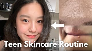 How to Create Your Own Skincare Routine for Teens affordable amp simple I Teen Korean Skincare [upl. by Dlanger651]