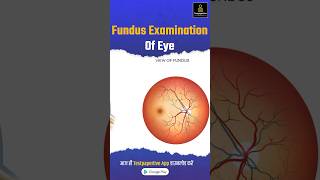 Funds Examination of eye explained simply in less than 60seconds funds examination ophthalmology [upl. by Morlee607]